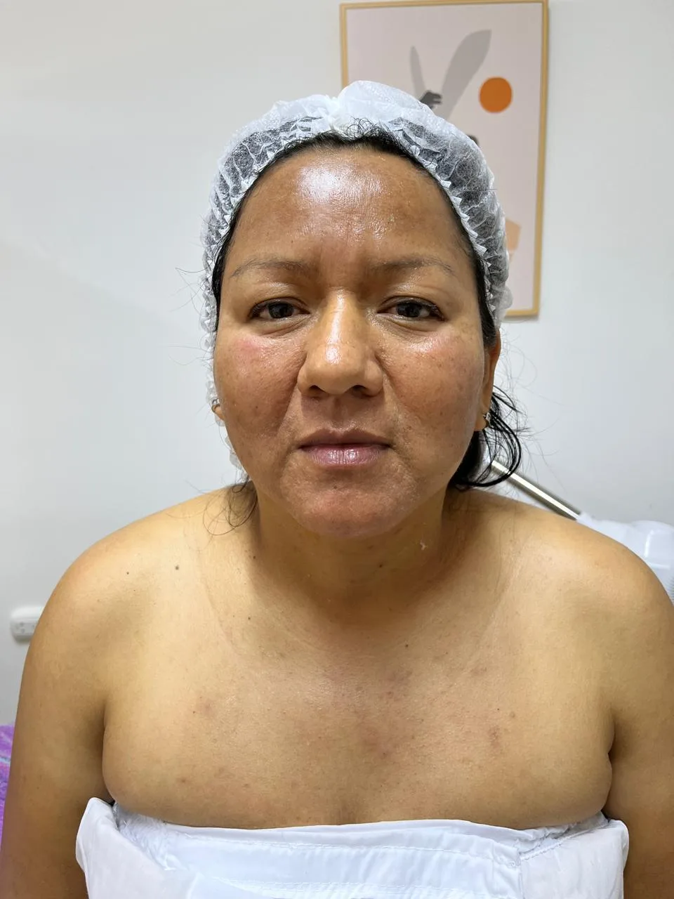 Después del tratamiento — resultado real 1, Klass Salón & Spa