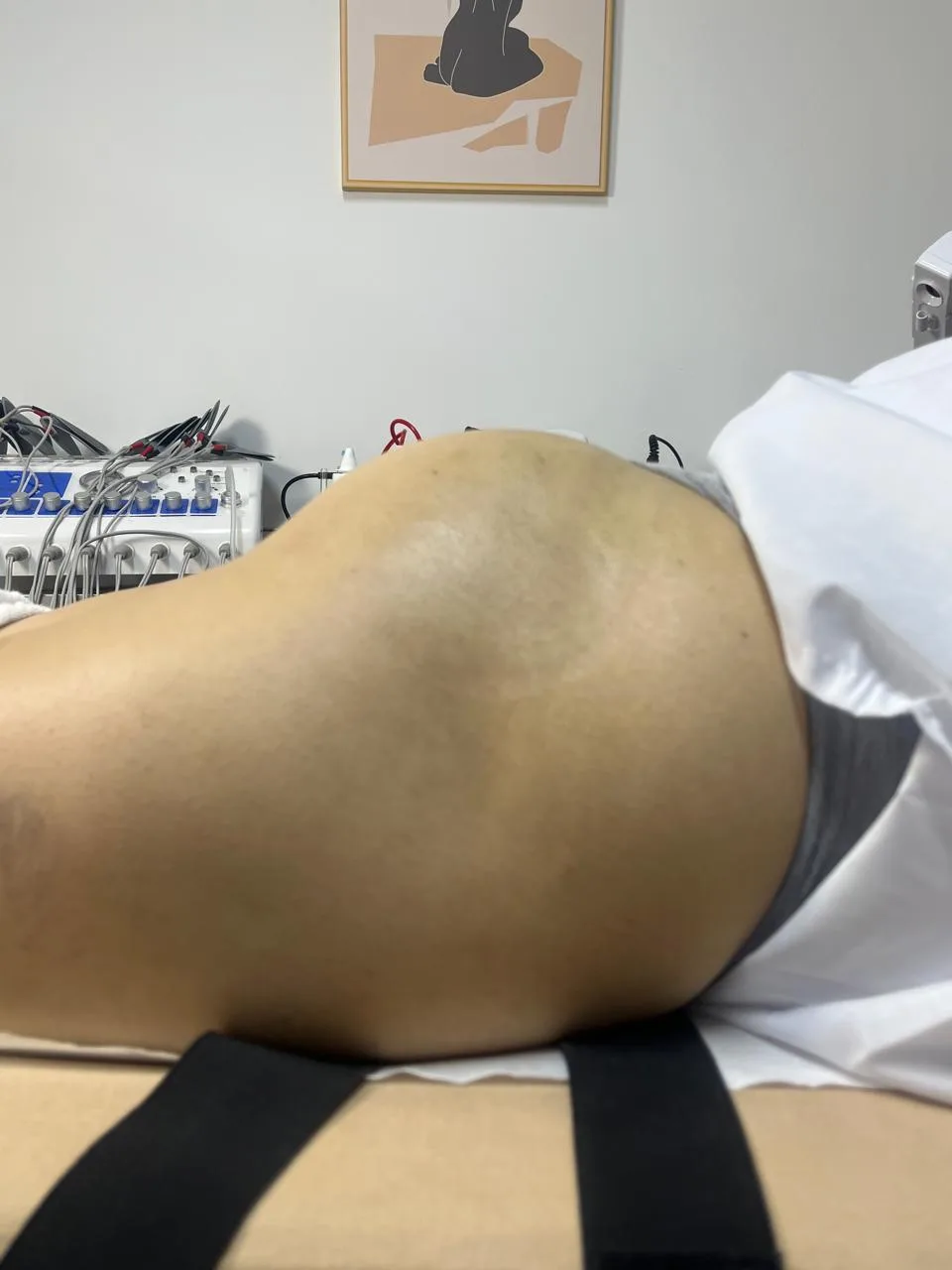 Después del tratamiento — resultado real 4, Klass Salón & Spa