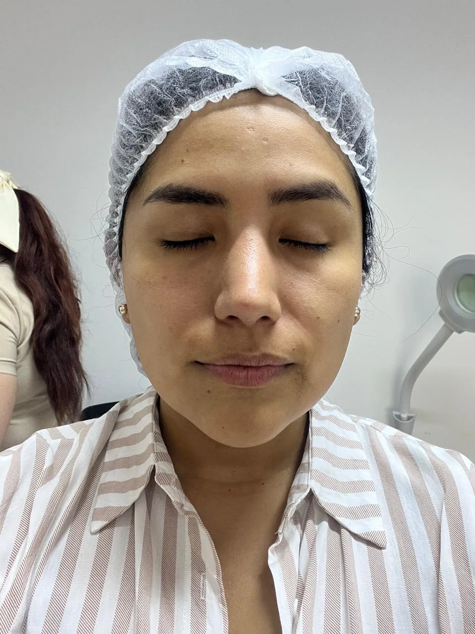 Antes del tratamiento — resultado real 5, Klass Salón & Spa