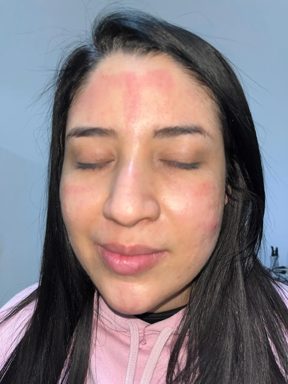 Después del tratamiento — resultado real 6, Klass Salón & Spa