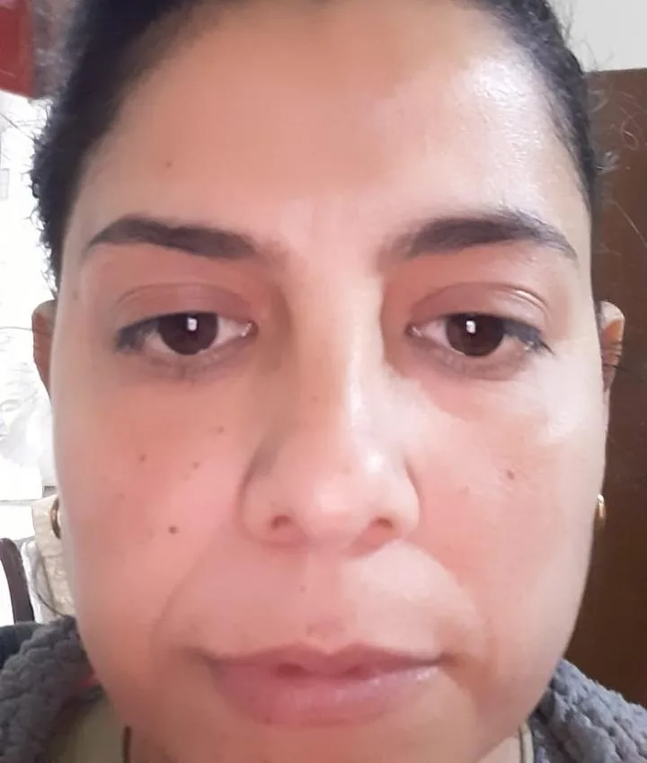 Después del tratamiento — resultado real 7, Klass Salón & Spa