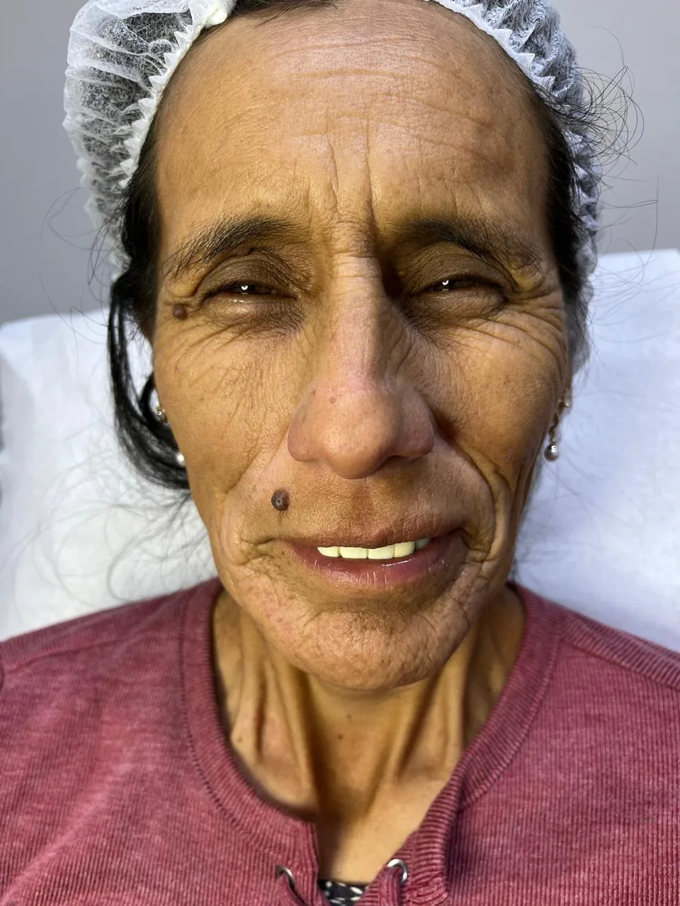 Rejuvenecimiento Facial en Klass Salón & Spa